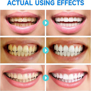 #1 Niacinamide Whitening Toothpaste